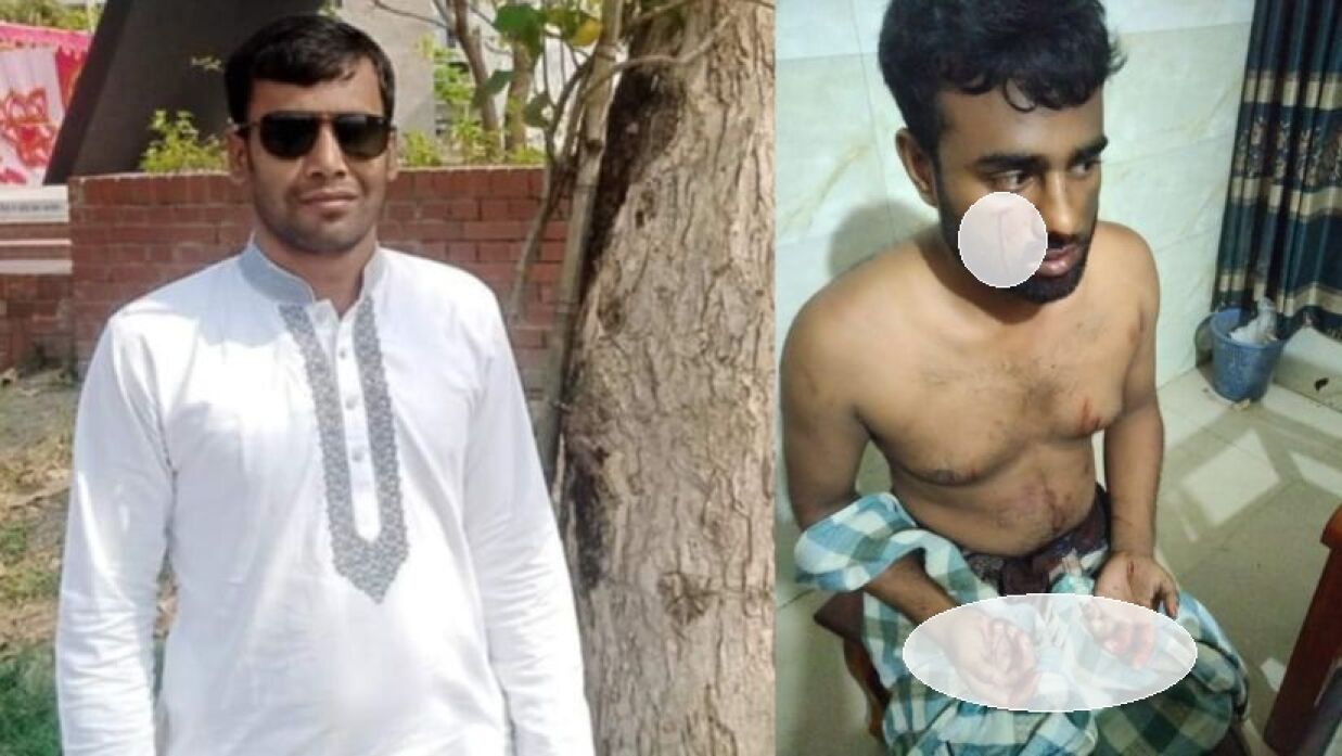 ছাত্রলীগ নেতার মারধরে হাসপাতালে  পাবিপ্রবি শিক্ষার্থী