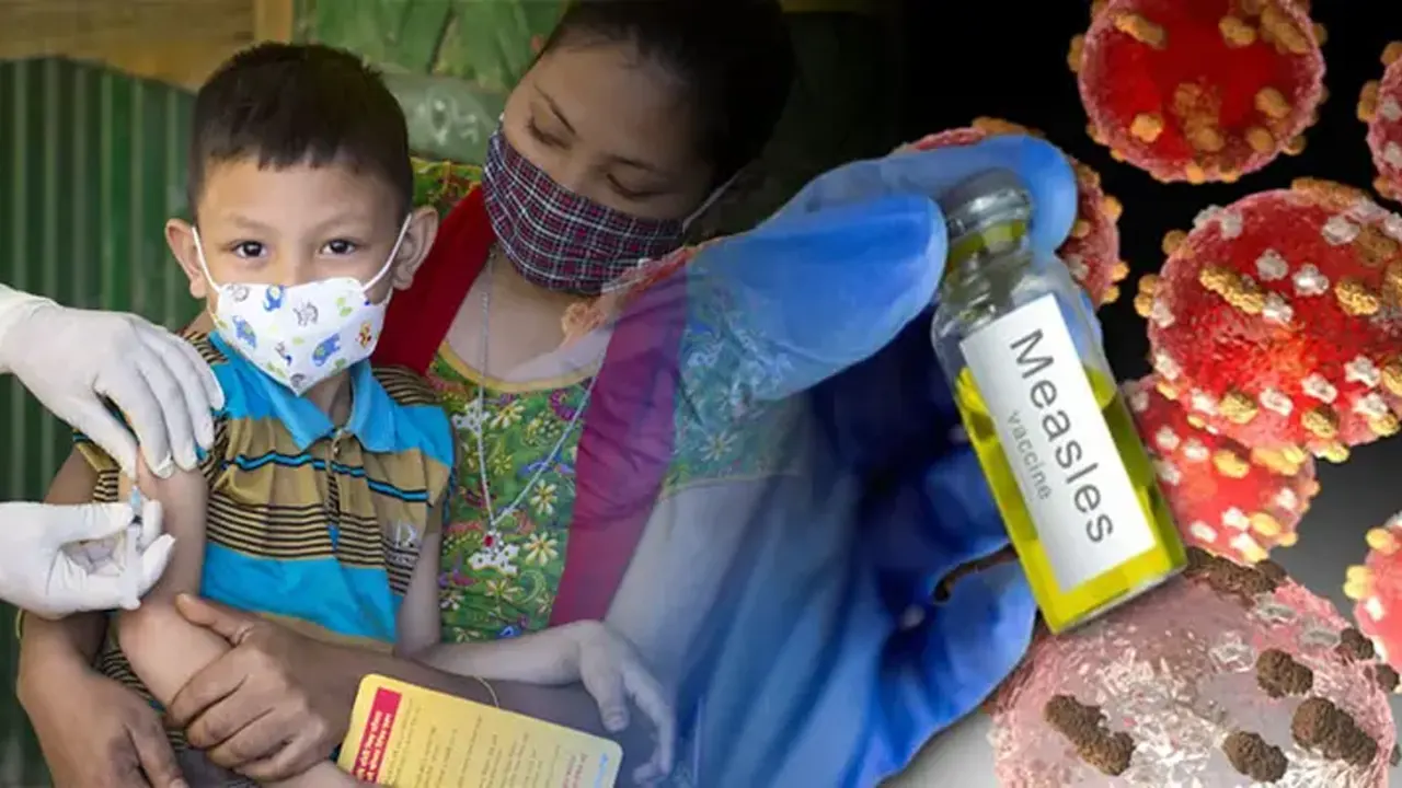 হাম মোকাবিলায় ৫ এপ্রিল থেকে টিকাদান কর্মসূচি শুরু