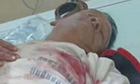 চারঘাটে আ’লীগ নেতাকে কুপিয়েছে দুর্বৃত্ত্বরা