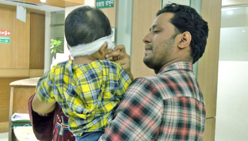 বাম চোখের বদলে শিশুর ডান চোখে অপারেশন
