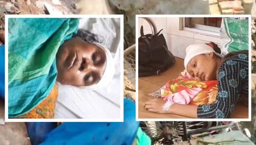 রাজশাহীতে প্রতিপক্ষের হামলায় মা-মেয়ে জখম, থানায় মামলা