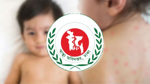 হাম ও উপসর্গে আরও ৬ শিশুর মৃত্যু